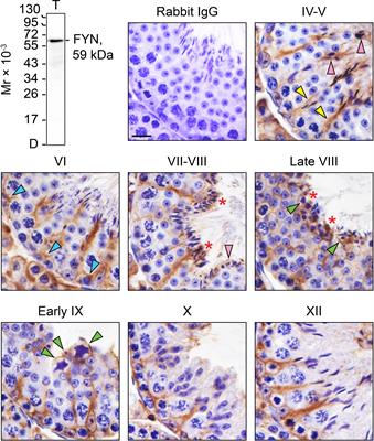 FYN regulates cell adhesion at the blood-testis barrier and the apical ectoplasmic specialization via its effect on Arp3 in the mouse testis